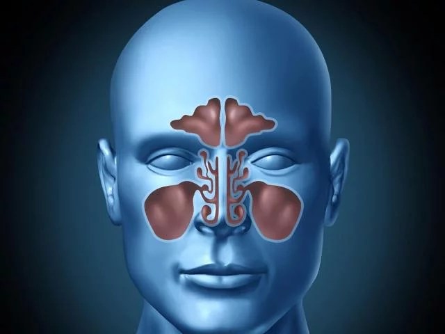 Kronik sinüzit iyileşmiyorsa nedeni mesleğiniz&nbsp;olabilir